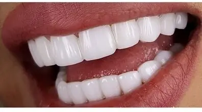 فیلم دیدنی از دندان پزشکی ایرانی که دندون های خودش رو درست میکنه