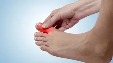 درمان خانگی فرو رفتن ناخن پا در گوشت + فیلم 