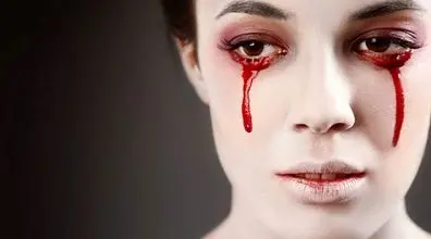 عکس های وحشتناک دختر جوانی که خون گریه می کند!! 