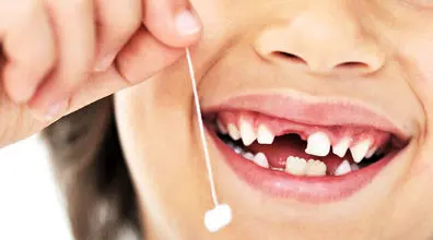 درمان سرطان با دندان شیری امکان داره؟ + توضیحات 