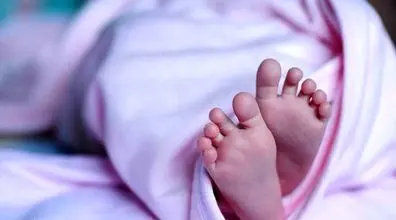 (ویدیو) تولد نوزاد وحشتناک با چهار دست و پا همه رو شوکه کرد