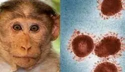 آبله میمون به بابل رسید!! | شیوع بیماری آبله میمون