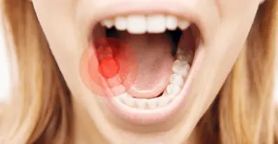 اگه نمیخوای سکته کنی مواظب دندونات باش | رابطه پوسیدگی دندان و بیماری قلبی