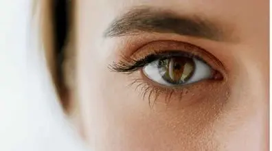 علت پرش پلک چیه؟ | درمان خانگی پرش پلک چشم + ویدیو 