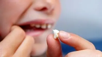 ۷ عادت‌ رایج که دندان‌ ها را نابود می‌کند! | برای محافظت از دندون هات هرگز این کارهارو انجام نده 