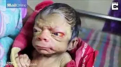 فیلم عجیب از تولد نوزادی شبیه میمون!! 