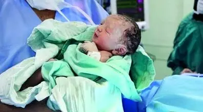 نوزاد عجیبی که 2 بار متولد شد! + عکس