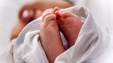 به دنیا آمدن نوزاد 2 سر در قم + عکس