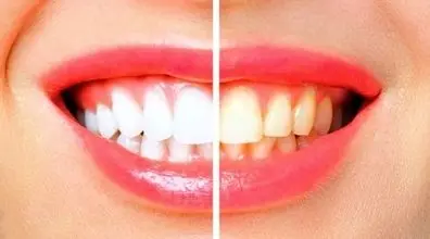 آویشن استفاده کنی دیگه کارت به دندون پزشکی نمی رسه! | فواید آویشن برای سلامت دهان و دندان