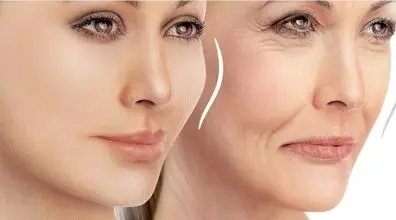 روش های از بین بردن چروک صورت و اصلاح خط لبخند
